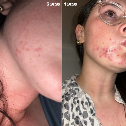 סילין ראש גשם מסנן למקלחת