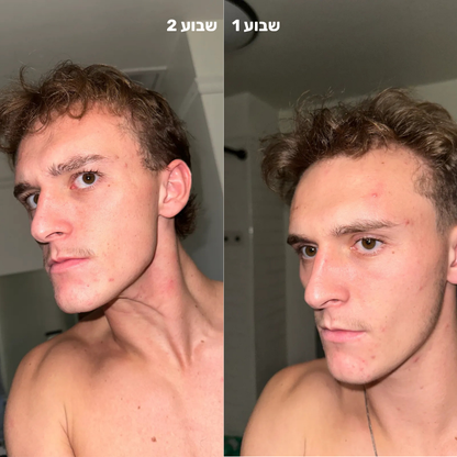 סילין ראש גשם מסנן למקלחת