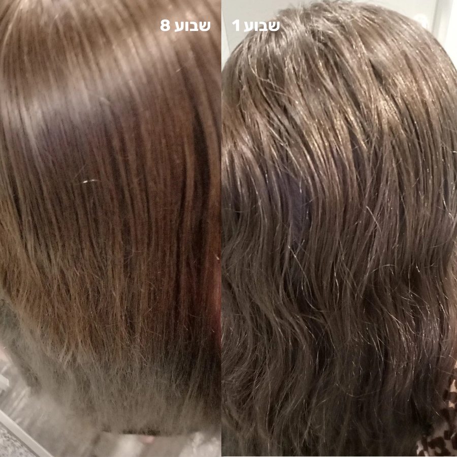 סילין ראש גשם מסנן למקלחת