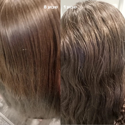 סילין ראש גשם מסנן למקלחת